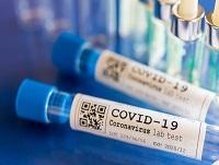 Image of Covid-19 medical vials